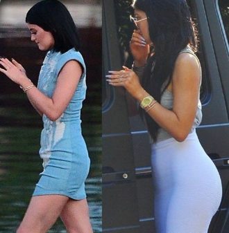 El Antes y Después de Kylie Jenner - Daiquiri Girl Blog