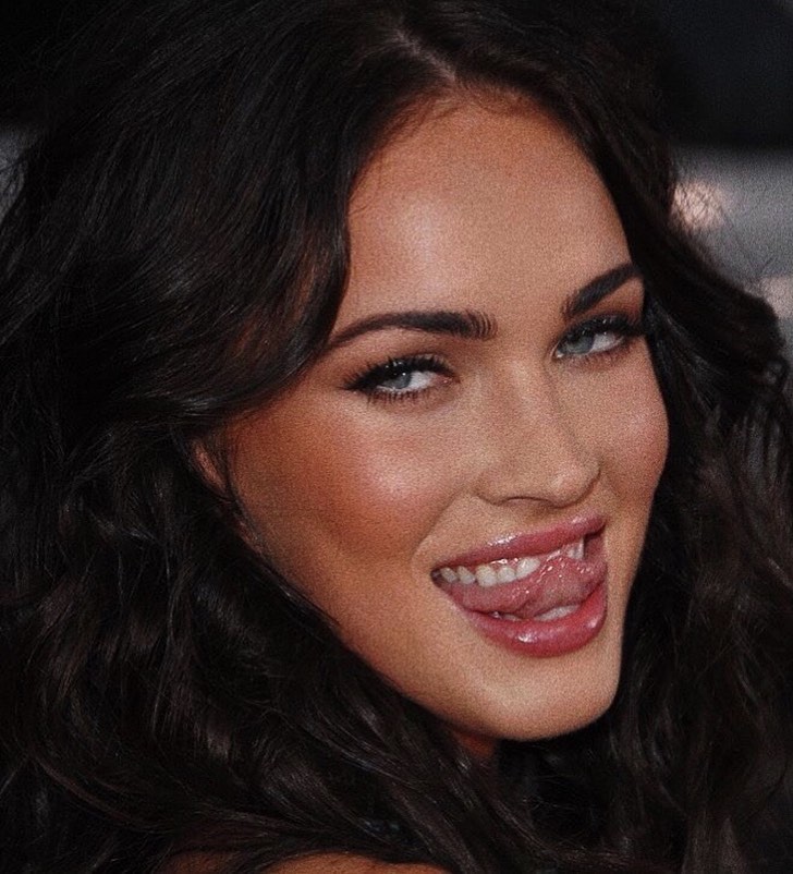 Cirugía de Pómulos Opiniones